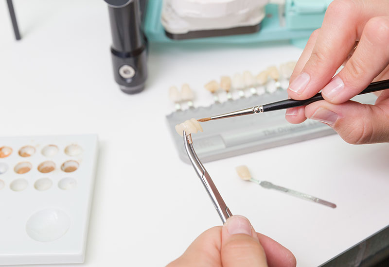 Ein Zahntechniker färbt mit einem Pinsel Zahnkronen ein.
